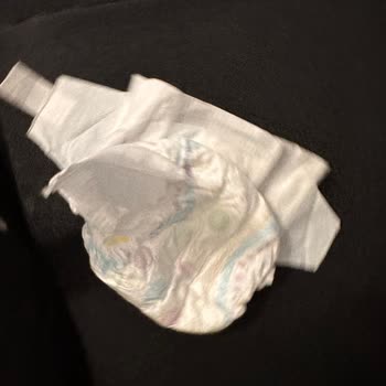 Molfix Bebek Bezlerinde Bant Kopması