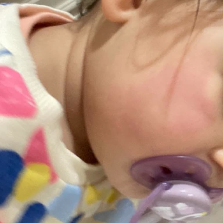 Sebamed Bebek Kremi Kullanımından Şiddetli Cilt Reaksiyonu Ve İade Talebi