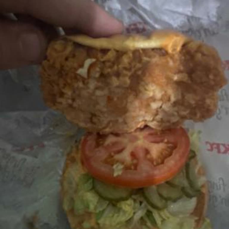 KFC Siparişinde Alerjime Rağmen Yanlış Malzeme Ve Gerekçesiz İade Reddi