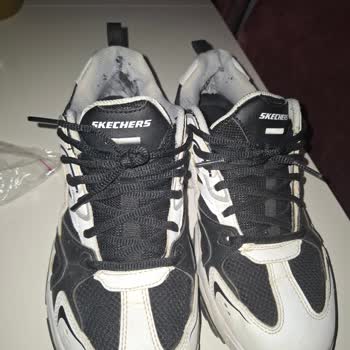 Skechers Ayakkabısındaki İç Astar Yırtılması Ve Mağazanın Haksız Kullanıcı Hatası Reddi