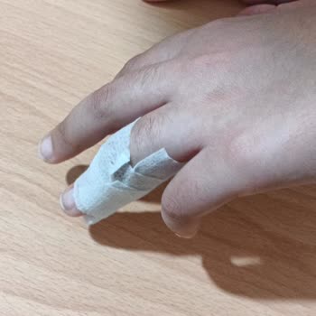 Acil Serviste Çocuğuma Rapor Verilmedi Ve Atel Yanlış Uygulandı