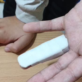 Acil Serviste Çocuğuma Rapor Verilmedi Ve Atel Yanlış Uygulandı