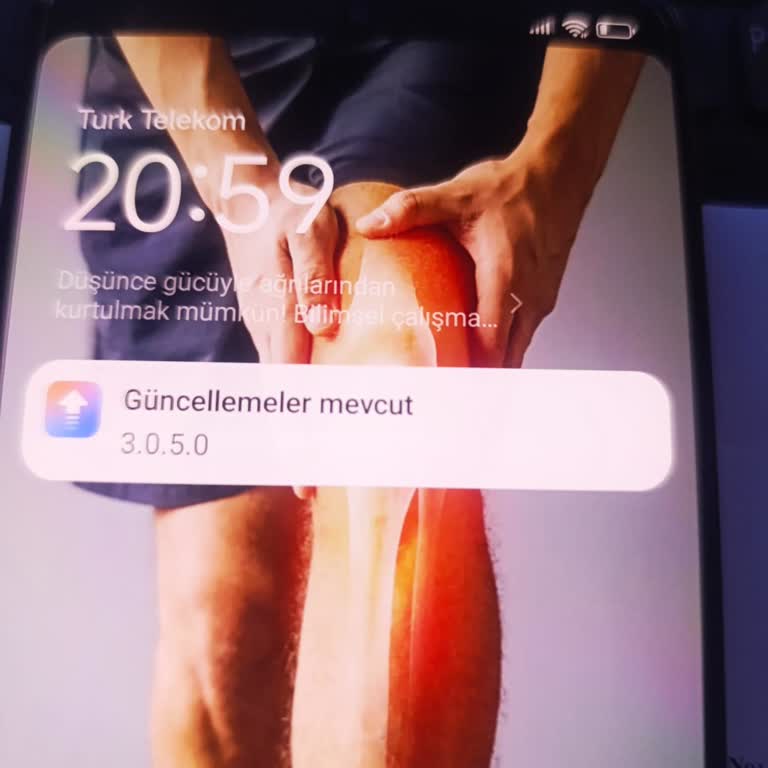 Yazılım Güncellemesi Yüklenmiyor Ve Satıcıya Ulaşılamıyor