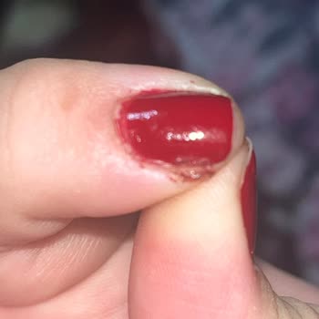 Özlem Kaya Beauty Center | Niğde Kötü Deneyim