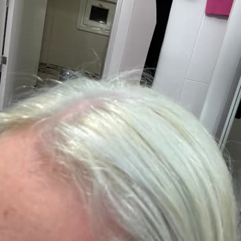 Saçım 10 Dakikada Masmavi Oldu, Ürün Açıklamaya Uymadı Ve Mahvedildi