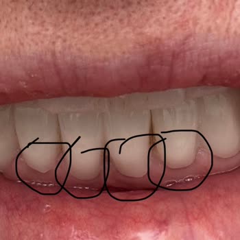 Aksu Clinic Dental Art Yapılan Hatalı ve Kalitesiz Tedavi İçin Maddi Tazminat Talep Ediyorum