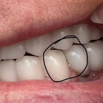 Aksu Clinic Dental Art Yapılan Hatalı ve Kalitesiz Tedavi İçin Maddi Tazminat Talep Ediyorum