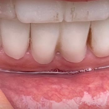 Aksu Clinic Dental Art Yapılan Hatalı ve Kalitesiz Tedavi İçin Maddi Tazminat Talep Ediyorum