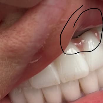 Aksu Clinic Dental Art Yapılan Hatalı ve Kalitesiz Tedavi İçin Maddi Tazminat Talep Ediyorum