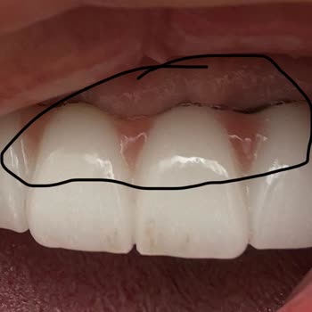 Aksu Clinic Dental Art Yapılan Hatalı ve Kalitesiz Tedavi İçin Maddi Tazminat Talep Ediyorum