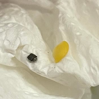 Mercimek İçinde Böcekler: Gıda Güvenliği Endişesi