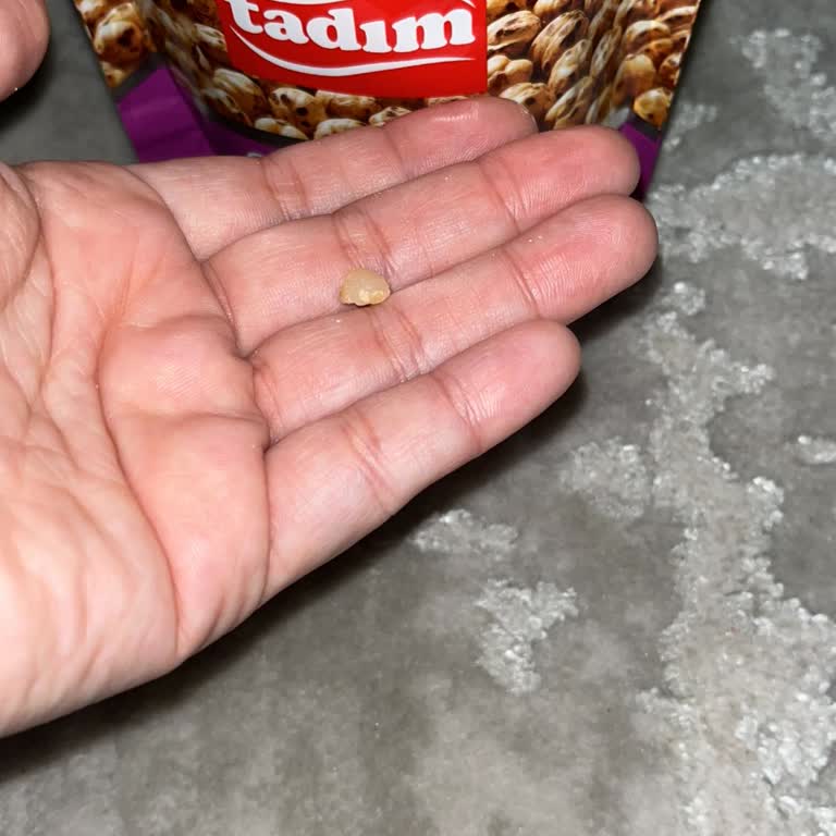 Tadım Sarı Leblebi Ürününü Tüketirken, Aşırı Sert Bir Taneye Denk Geldim Ve Dişim Kırıldı