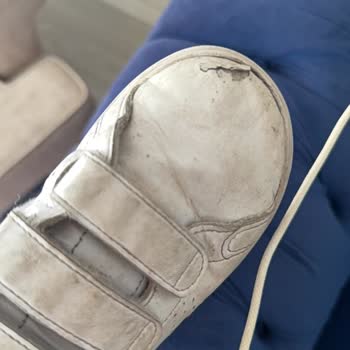 Adidas Ayakkabısı 5 Ayda Yırtıldı, Mağaza Çözüm Sunmadı