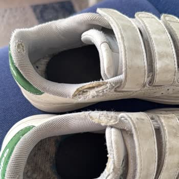 Adidas Ayakkabısı 5 Ayda Yırtıldı, Mağaza Çözüm Sunmadı