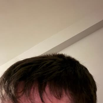 Songül Erdoğdu Güzellik & Kuaför Salonu Saçım Çok Daha Fazla Kısaltıldı, Farklı Şekil Verildi