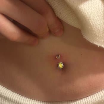 Overdose Piercing Kadıköy'de Yanıltıcı Kampanya Ve Hijyen Sorunu Nedeniyle Enfeksiyon Ve İade Talebi