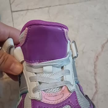 Aşırı Sert Ayakkabı Ucu Çocuğumun Bileğine Yara Açtı, İade Ve Ücret İadesi Talebi