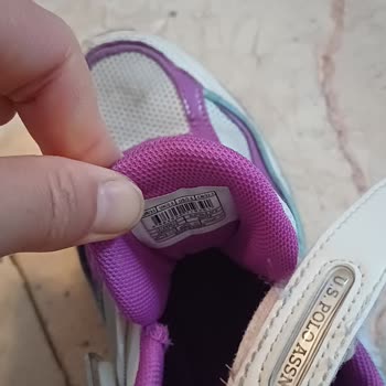 Aşırı Sert Ayakkabı Ucu Çocuğumun Bileğine Yara Açtı, İade Ve Ücret İadesi Talebi