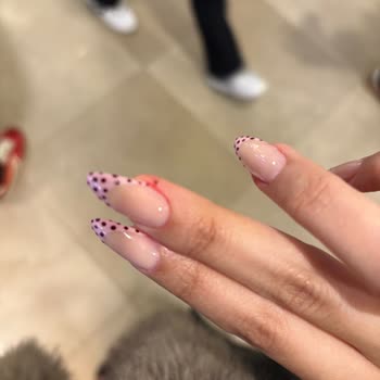 Protez Tırnakta Aşırı Kesim Ve Ağrı, Görünüm Bozukluğu Ve Ücret İadesi Talebi