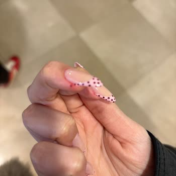 Protez Tırnakta Aşırı Kesim Ve Ağrı, Görünüm Bozukluğu Ve Ücret İadesi Talebi