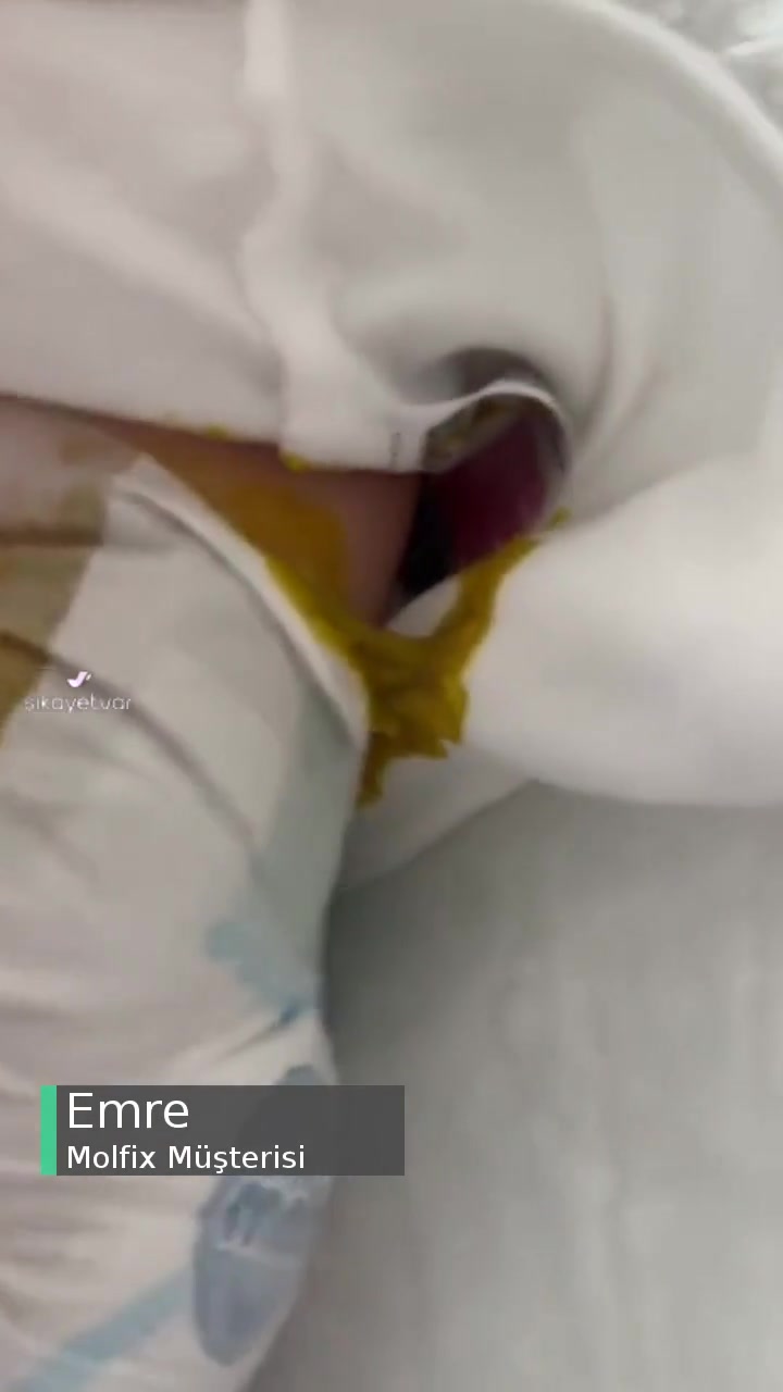 Molfix Bezlerde Taşma Problemi videonun kapak resmi