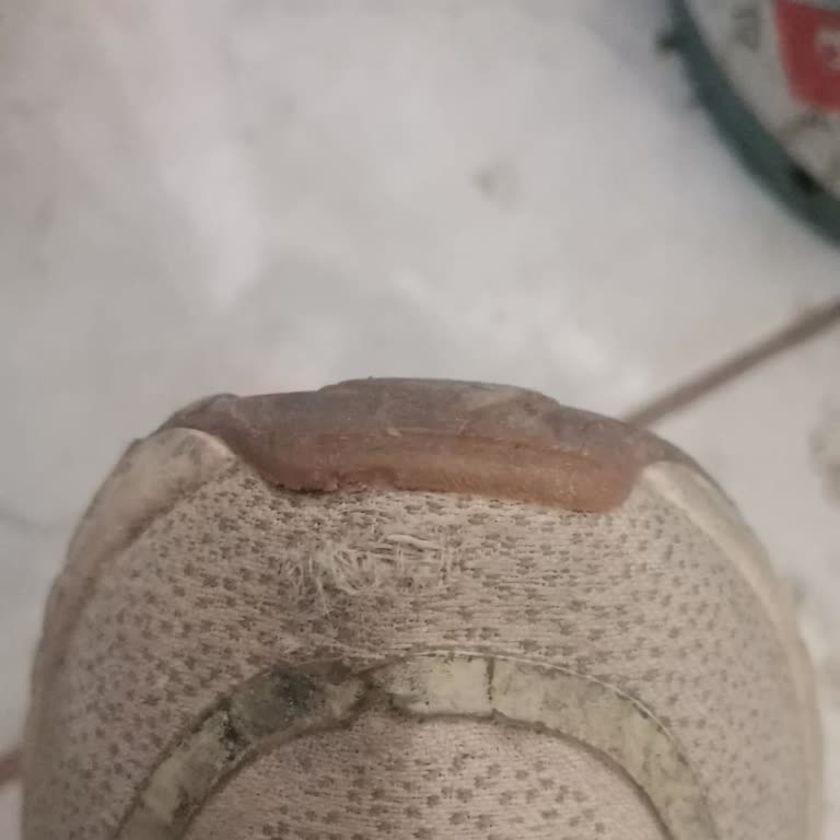 Garanti Kapsamında Deforme Olmuş Ayakkabı Ve Mağaza İhmaline Karşı Şikayet