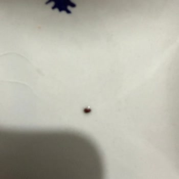 Bebek Tarhanasında Canlı Böcek Bulunması Ve Müşteri Hizmetlerine Ulaşılamaması