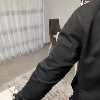 Puma Montunda Aşırı Tüy Dökülmesi Ve İade Talebi