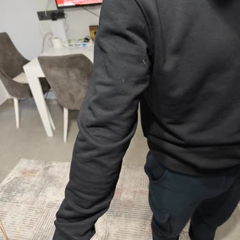 Puma Montunda Aşırı Tüy Dökülmesi Ve İade Talebi