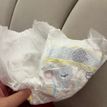 Molfix 2 Numaralı Bebek Bezinde Küflenmiş Görünüm Ve Bebek Sağlığı Endişesi