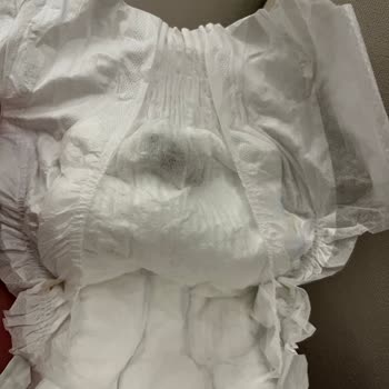 Molfix 2 Numaralı Bebek Bezinde Küflenmiş Görünüm Ve Bebek Sağlığı Endişesi