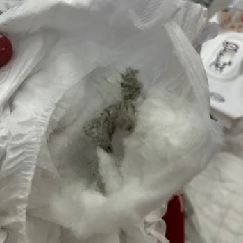 Molfix 2 Numaralı Bebek Bezinde Küflenmiş Görünüm Ve Bebek Sağlığı Endişesi