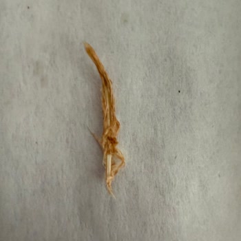 Tavuk Dürümde Tüy Çıktı Ve Ürünler Eksik, İade Talebim Reddedildi