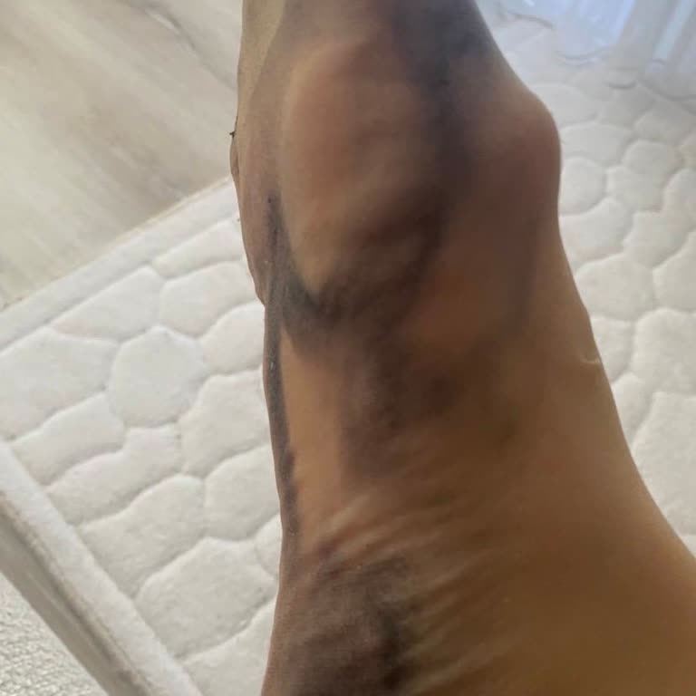 Ayaklarımı Siyaha Boyayan Ayakkabı İadesi Reddedildi