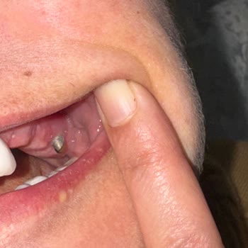 DT. Tarık İğdirli Hem Sağlık Açısından Hem de Maddi Açıdan Beni Çok Zor Durumda Bıraktı