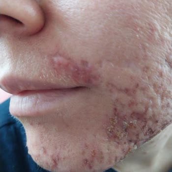 Yanık İzleri Ve Cevapsız Müşteri Hizmeti