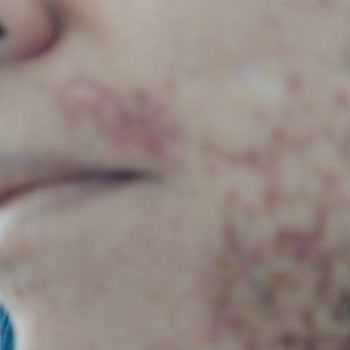 Yanık İzleri Ve Cevapsız Müşteri Hizmeti