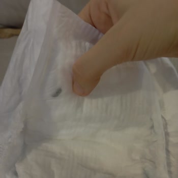 Bebek Bezinde Böcek Benzeri Yabancı Madde Görüldü: Sağlık Endişesi