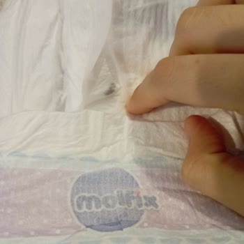 Bebek Bezinde Böcek Benzeri Yabancı Madde Görüldü: Sağlık Endişesi