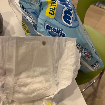 Molfix Bebek Bezinde Siyah Yabancı Madde Ve Sağlık Endişesi