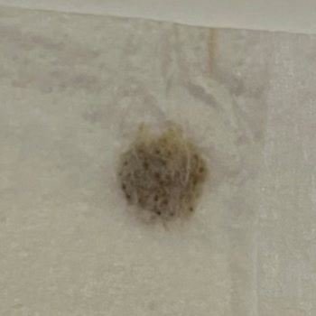 Molfix Bebek Bezinde Siyah Yabancı Madde Ve Sağlık Endişesi