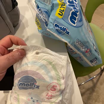 Molfix Bebek Bezinde Siyah Yabancı Madde Ve Sağlık Endişesi