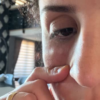 Dermaluxe Ankara İşlem Sonrasında Göz Altlarımda Şişlik, Ağrı Ve Geçmeyen Morluklar Olması