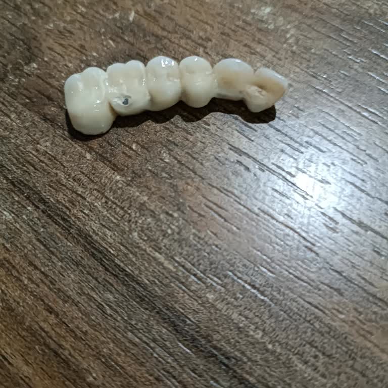 Göraldent Diş Kliniği Parayı Alana Kadar İlgilenip, Sonrasında Hiçbir Sorumluluk Kabul Etmediler