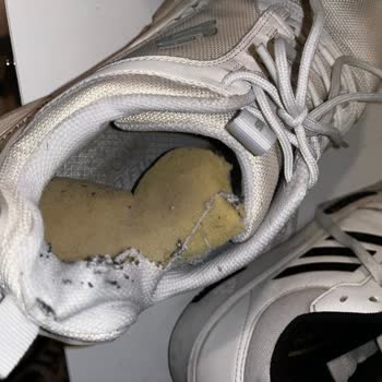 Skechers Ayakkabısının Tabanında Çözülme Ve İade Sistemindeki Hata