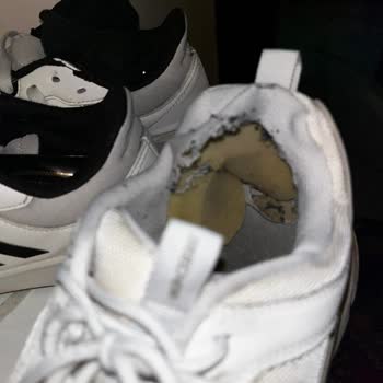 Skechers Ayakkabısının Tabanında Çözülme Ve İade Sistemindeki Hata