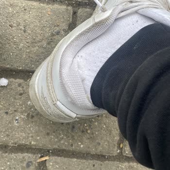 Kopwear Ayakkabısında Açılma Ve Pamuk Çıkması, Müşteri Hizmetleri İlgisizliği