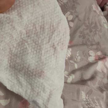 Sleepy Yüzey Temizlik Havlularının Kalitesinde Ani Düşüş