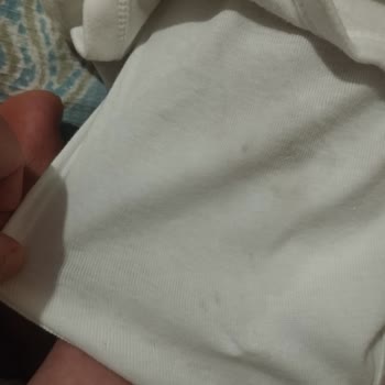 Molfix Bebek Bezinde Sürekli Sızıntı Problemi