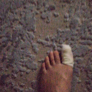 Enza Home Wardrobe Door Fell Off – Customer Injured After Service Delay